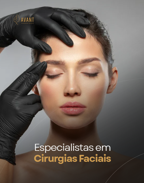 post-instagram-avant-cirurgia-facial